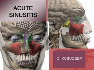 ACUTE SINUSITIS Dr KCSUDEEP Sinusitis is an infection