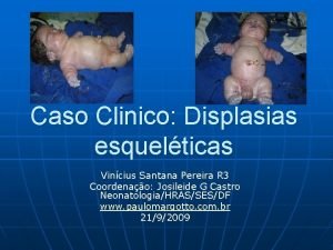 Caso Clinico Displasias esquelticas Vincius Santana Pereira R