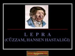 Lepra