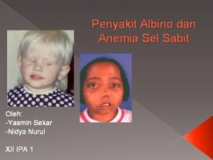Gambar anemia sel sabit Gambar anemia sel sabit