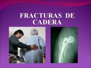 Clasificacion de fracturas de cadera