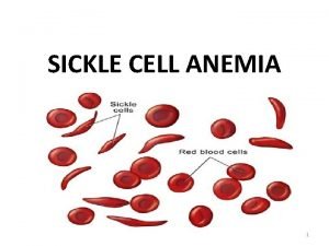 SICKLE CELL ANEMIA 1 What Is Sickle Cell
