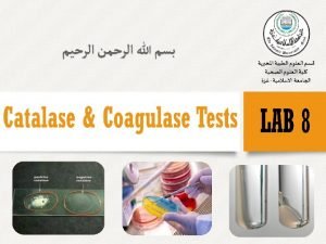 Enzymes v In the microbiology lab biochemical test