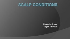 SCALP CONDITIONS Alopecia Areata Telogen effluvium q Hair