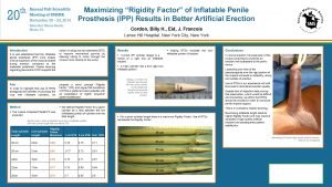 Maximizing Rigidity Factor of Inflatable Penile Prosthesis IPP