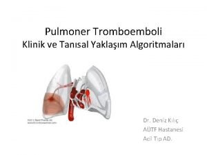 Pulmoner Tromboemboli Klinik ve Tansal Yaklam Algoritmalar Dr