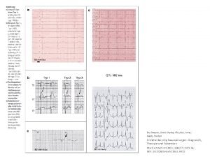 Beckmann BrittMaria Pfeufer Arne Kb Stefan Erbliche Herzrhythmusstrungen