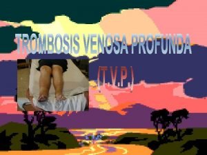 Signo de homans y ollow Signo de homans y ollow