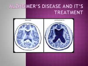 ALZHEIMERS DISEASE AND ITS TREATMENT WHAT IS ALZHEIMERS