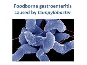 Foodborne gastroenteritis caused by Campylobacter Characters Campylobacter C