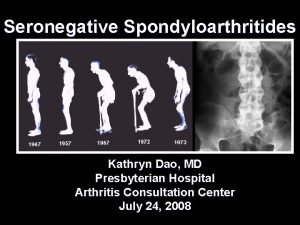 Seronegative Spondyloarthritides Kathryn Dao MD Presbyterian Hospital Arthritis