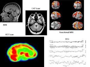 CAT Scan MRI PET Scan Functional MRI EEG
