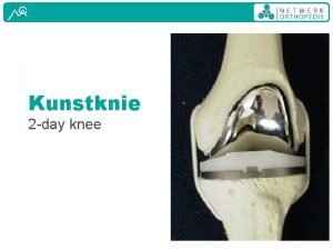 Kunstknie 2 day knee Beloop Operatie op de