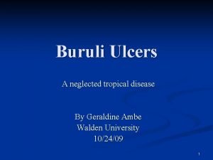 Buruli Ulcers A neglected tropical disease By Geraldine