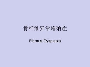 Fibrous Dysplasia craniofacial fibrous dysplasia skull and facial