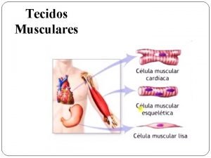 Musculo estriado esqueletico nucleos
