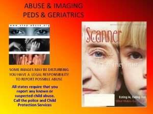 ABUSE IMAGING PEDS GERIATRICS SOME IMAGES MAY BE