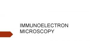 IMMUNOELECTRON MICROSCOPY ELECTRON MICROSCOPY Electron microscopy EM is