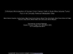 Orthotopic Microinjection of Human Colon Cancer Cells in
