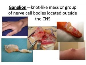 Knot like mass of nerve cell bodies