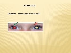 Leukocoria causes