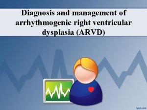 Diagnosis and management of arrhythmogenic right ventricular dysplasia