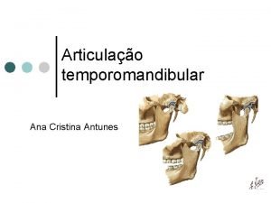 Articulao temporomandibular Ana Cristina Antunes Articulao temporomandibular ATM