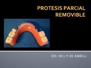 Protesis parcial removible clase 3 modificacion 1