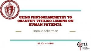 USING PHOTOGRAMMETRY TO QUANTIFY VITILIGO LESIONS ON HUMAN