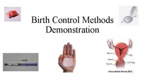 Birth Control Methods Demonstration Contraceptives Brainstorm What are