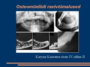 Osteomeliidi ravivimalused Karyna Kaerama stom IV rhm II
