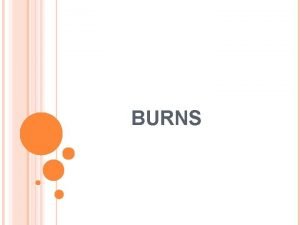 BURNS BURNS Types of burns Depths of burns