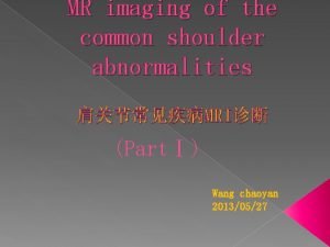 MR imaging of the common shoulder abnormalities MRI
