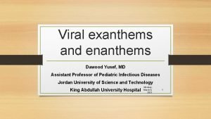 Viral exanthems and enanthems Dawood Yusef MD Assistant