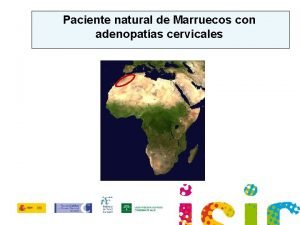 Paciente natural de Marruecos con adenopatas cervicales Paciente