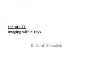 Lecture 11 Imaging with Xrays Dr Sarah Bohndiek