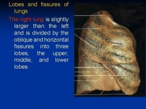 Right lung fissures