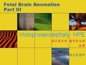 Fetal Brain Anomalies Part III Holoprosencephaly HPE Severe
