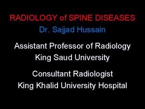 RADIOLOGY of SPINE DISEASES Dr Sajjad Hussain Assistant