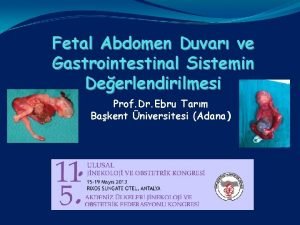 Fetal abdomen nedir