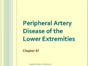Peripheral Artery Disease of the Lower Extremities Chapter