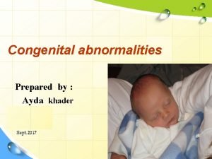 Congenital abnormalities Prepared by Ayda khader Sept 2017