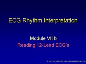 ECG Rhythm Interpretation Module VII b Reading 12