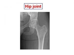 Hip joint type and subtype