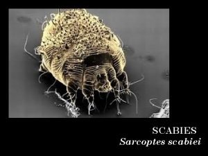 Scabies under microscope