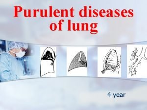 Purulent diseases of lung 4 year I Pathogenesis