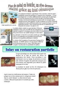 Dgts engendrs par la corrosion Les amalgames dentaires