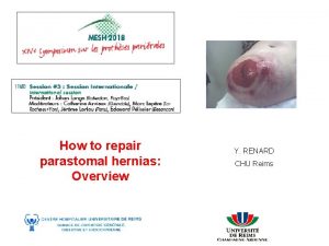 How to repair parastomal hernias Overview Y RENARD