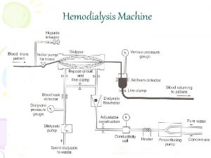 Hemodialysis Machine Hemodialysis Machine Basic Functions of Hemodialysis