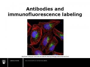 Antibodies and immunofluorescence labeling http www cellsignal comcommoncontent